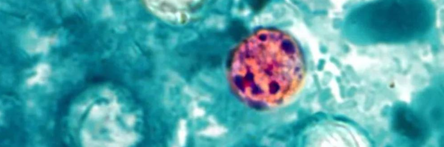 Protecting Your Plate from Cyclospora